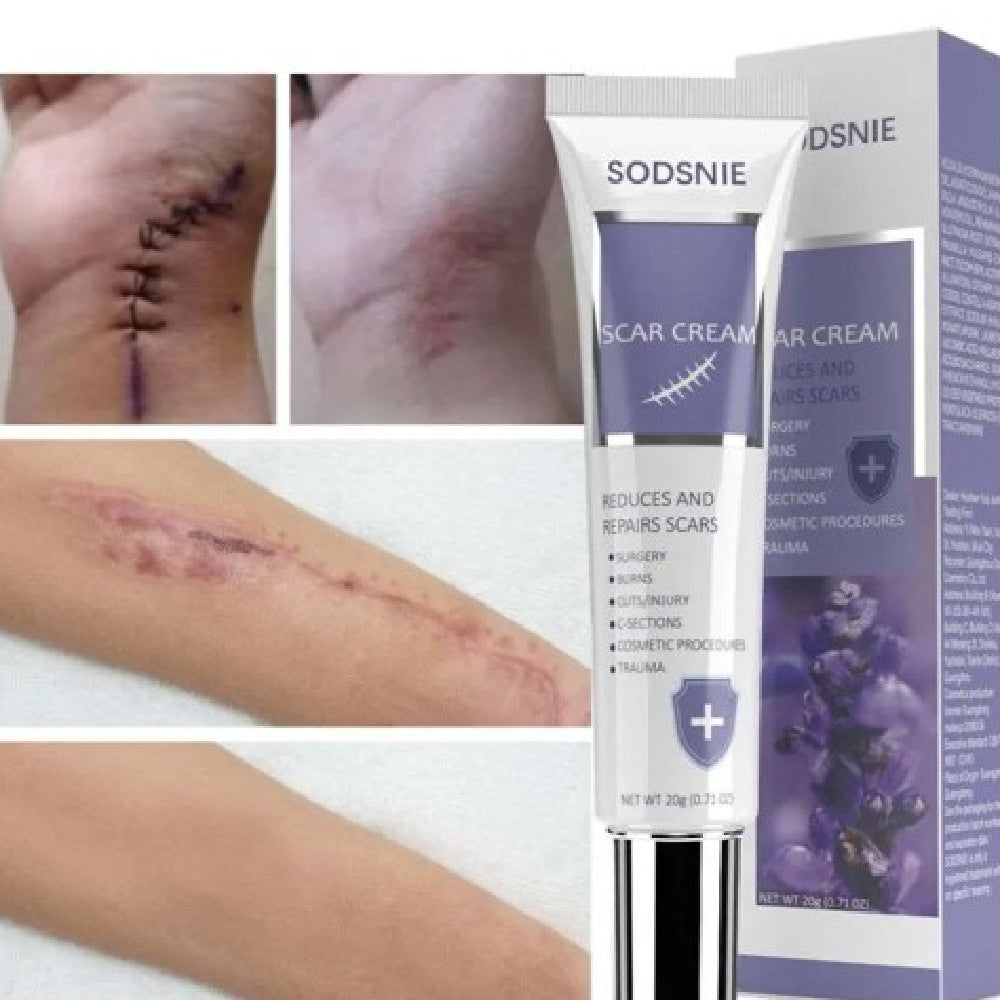 Advanced Scar Cream 20G